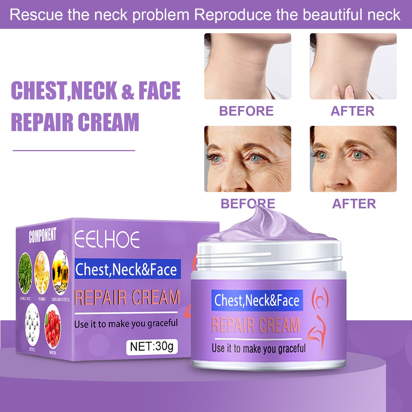 EELHOE FADE CREMA PER RUGHE DEL COLLO E VISO