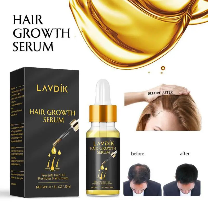 LAVDIK SERUM ANTIPERDTA CAPELLI
